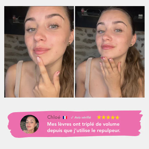 Extreme Plumper