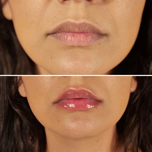 Repulpeur Lèvres Extrême Sans Injection | BYMEE COSMETIC