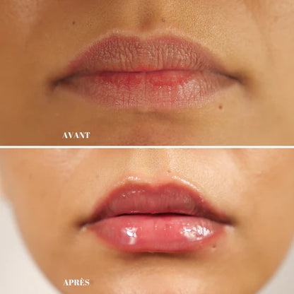 Repulpeur Lèvres Extrême Sans Injection | BYMEE COSMETIC