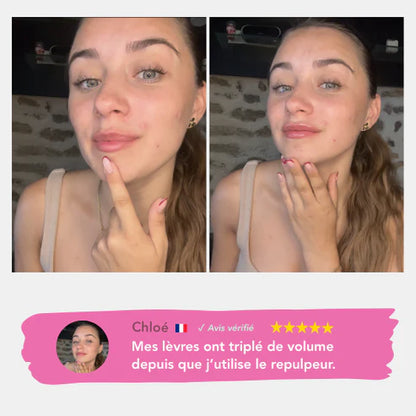 Repulpeur Lèvres Extrême Sans Injection | BYMEE COSMETIC